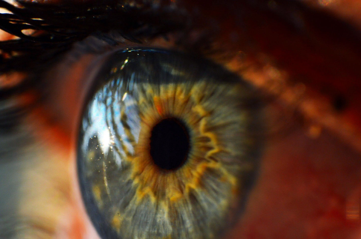 Tränenfilm Auge Hornhaut Cornea Tränenfilmanalyse 